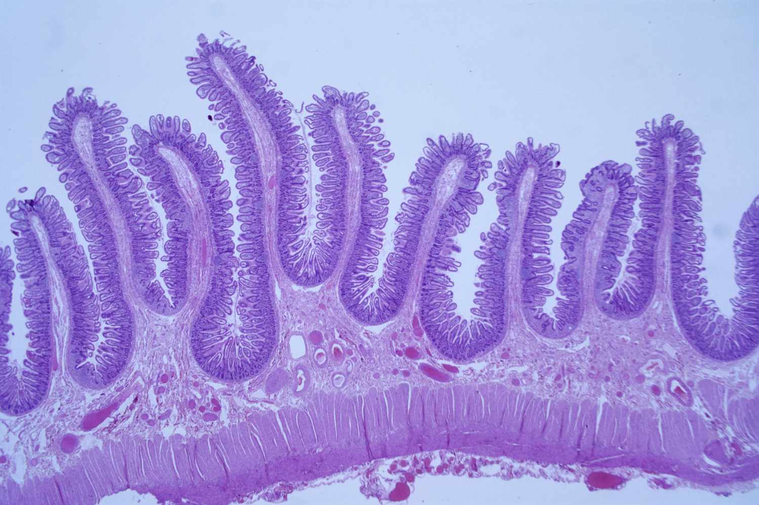 Histopathology Slide