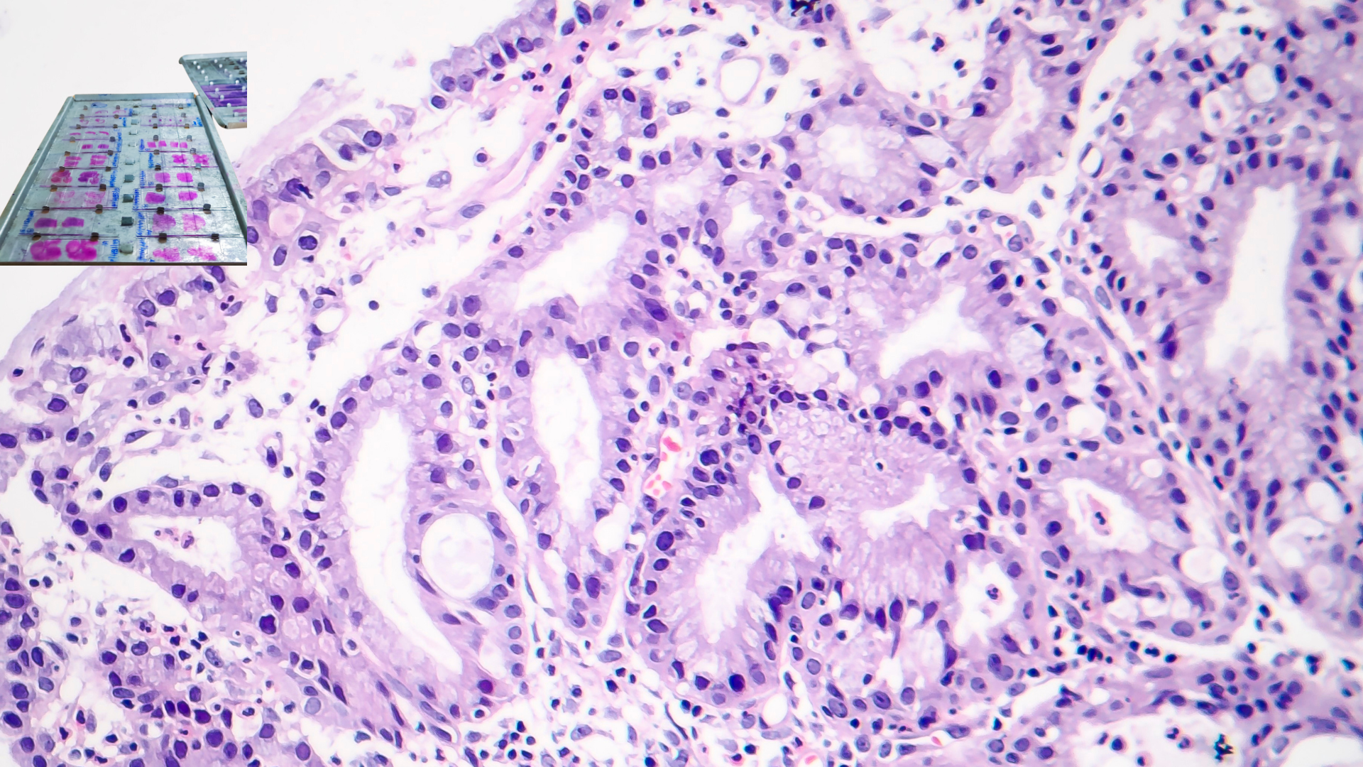 Histopathology Slide