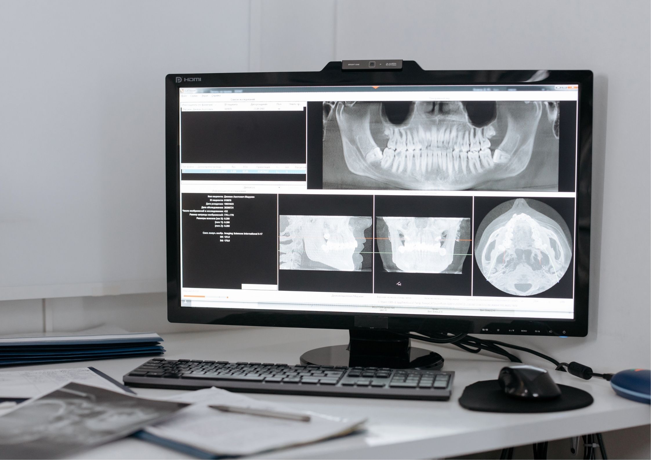 Digital X-ray Image